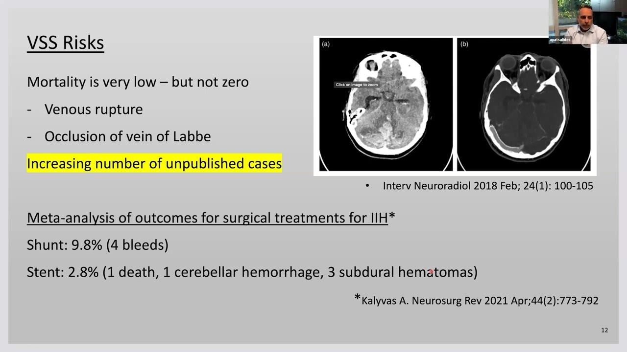 IIH Surgical Interventions - Video 2