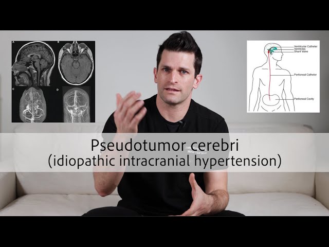 IIH Explained - Video 5